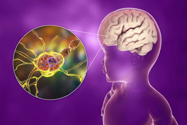 Demyelinating Disorder